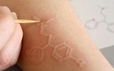 [ẢNH] Kỳ lạ chứng da vẽ nổi xuất hiện trên cơ thể con người 