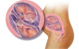 [Ảnh] Những điều nên biết và cần lưu ý khi mang thai đôi