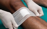 [ẢNH] Dấu hiệu và cách phòng tránh bệnh vi khuẩn 'ăn thịt người' Whitmore sau mùa mưa lũ