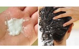 [ẢNH] 10 cách trị gàu đơn giản hiệu quả 