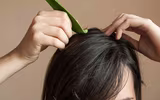 [ẢNH] 10 cách trị gàu đơn giản hiệu quả 