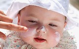 [Ảnh] Những lưu ý về sức khỏe cho trẻ nhỏ khi thời tiết thay đổi