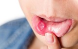 [ẢNH] Những dấu hiệu cảnh báo ung thư sớm, chớ xem thường!
