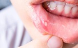 [ẢNH] Những dấu hiệu cảnh báo ung thư sớm, chớ xem thường!