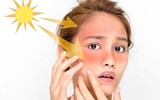 [Ảnh] Mẹo chữa trị nẻ môi, nẻ da mặt hiệu quả trong mùa hanh khô 
