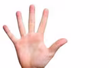 [ẢNH] Giải mã bí ẩn về những người không có dấu vân tay