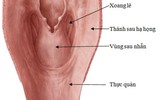 [ẢNH] Sự nguy hiểm khôn lường của ung thư hạ họng