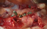 [ẢNH] Cảnh giác với ngộ độc thực phẩm mùa nắng nóng 