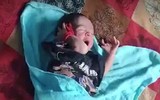 Trẻ sơ sinh có 26 ngón tay chân được tin là hiện thân của nữ thần Ấn Độ