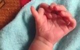 Trẻ sơ sinh có 26 ngón tay chân được tin là hiện thân của nữ thần Ấn Độ
