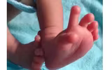 Trẻ sơ sinh có 26 ngón tay chân được tin là hiện thân của nữ thần Ấn Độ