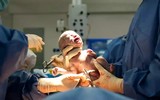 Trẻ sơ sinh có 26 ngón tay chân được tin là hiện thân của nữ thần Ấn Độ