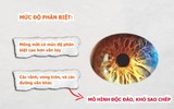 Mống mắt con người có gì đặc biệt? 