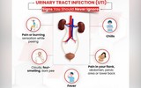 Những thói quen hàng ngày là nguyên nhân sinh ra sỏi trong thận