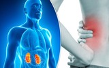 Những thói quen hàng ngày là nguyên nhân sinh ra sỏi trong thận