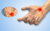 Những dấu hiệu cảnh báo sớm của bệnh tiểu đường