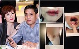 [ẢNH] Bi kịch bị chồng bạo hành của nhiều sao Việt