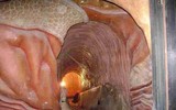Corpus- bảo tàng đầu tiên trên thế giới khám phá cơ thể người