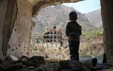 [ẢNH] Xót xa cậu bé Yemen 7 tuổi chỉ nặng có 7kg vì nạn đói