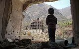 [ẢNH] Xót xa cậu bé Yemen 7 tuổi chỉ nặng có 7kg vì nạn đói