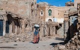 [ẢNH] Xót xa cậu bé Yemen 7 tuổi chỉ nặng có 7kg vì nạn đói
