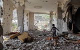 [ẢNH] Xót xa cậu bé Yemen 7 tuổi chỉ nặng có 7kg vì nạn đói