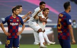 [ẢNH] Messi ôm mặt đau khổ trong đêm kinh hoàng của Barca