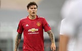 [ẢNH] Đội hình tối ưu của M.U sau khi có Cavani và Alex Telles
