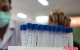 Xúc động hình ảnh chiến sỹ Công an, người nước ngoài cùng nhân dân hiến máu cứu người trong giãn cách xã hội