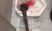 Trăn dài 3,3m chui lên bệt vệ sinh, tấn công bộ phận sinh dục người đàn ông