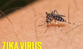 Ca tử vong đầu tiên do virus Zika ở Mỹ