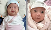 Hy hữu: Hai anh em sinh đôi chào đời cách nhau 5 tuần