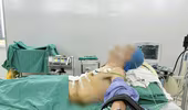 Hiếm gặp: Bệnh nhân ung thư dạ dày được phẫu thuật ở tư thế… nửa nằm nửa ngồi
