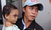 Xuất hiện cha đẻ bé 4 tuổi bị bạo hành