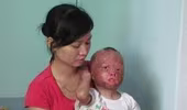 Thảm thương cháu bé bị cha tẩm xăng đốt 