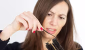 Tóc rụng, đâu chỉ tại… mùa thu