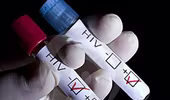 Bệnh nhân kiện bác sĩ vì tự ý xét nghiệm HIV