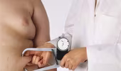 Nghiên cứu mới về khả năng ung thư của những người béo phì
