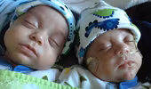Khó tin: Cặp song sinh chào đời...cách nhau 39 ngày 