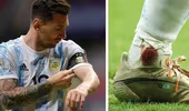 Sốc với hình ảnh cổ chân chảy máu của Messi ở bán kết Copa America