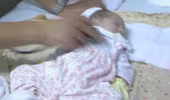 Bé sơ sinh suýt tử vong vì hít phải phân su 
