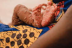 Nhiễm trùng đường hô hấp, sốt rét khiến nhiều người tử vong ở CHDC Congo