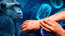 Các nước Đông Nam Á cảnh giác phòng ngừa dịch bệnh đậu mùa khỉ 