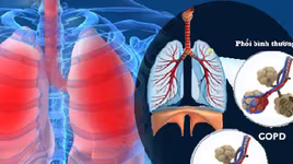 Những bệnh lý nguy hại về phổi