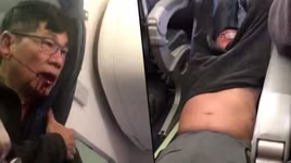 Hãng hàng không United Airlines đạt thỏa thuận với David Dao