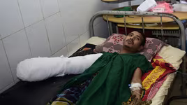 "Người cây" phẫu thuật loại bỏ 5kg "vỏ"