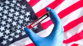 [ẢNH] Khống chế Covid-19 bước đầu thất bại, Mỹ trở thành vùng dịch lớn thứ ba thế giới