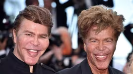 [ẢNH] 20 căn bệnh hiếm gặp nhất thế giới