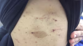 Bắt khẩn cấp  "ông trùm"  đường dây "điều đào", tra tấn nữ tiếp viên karaoke  dã man