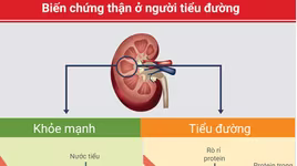 Bệnh thận đái tháo đường: Dấu hiệu và cách phòng ngừa